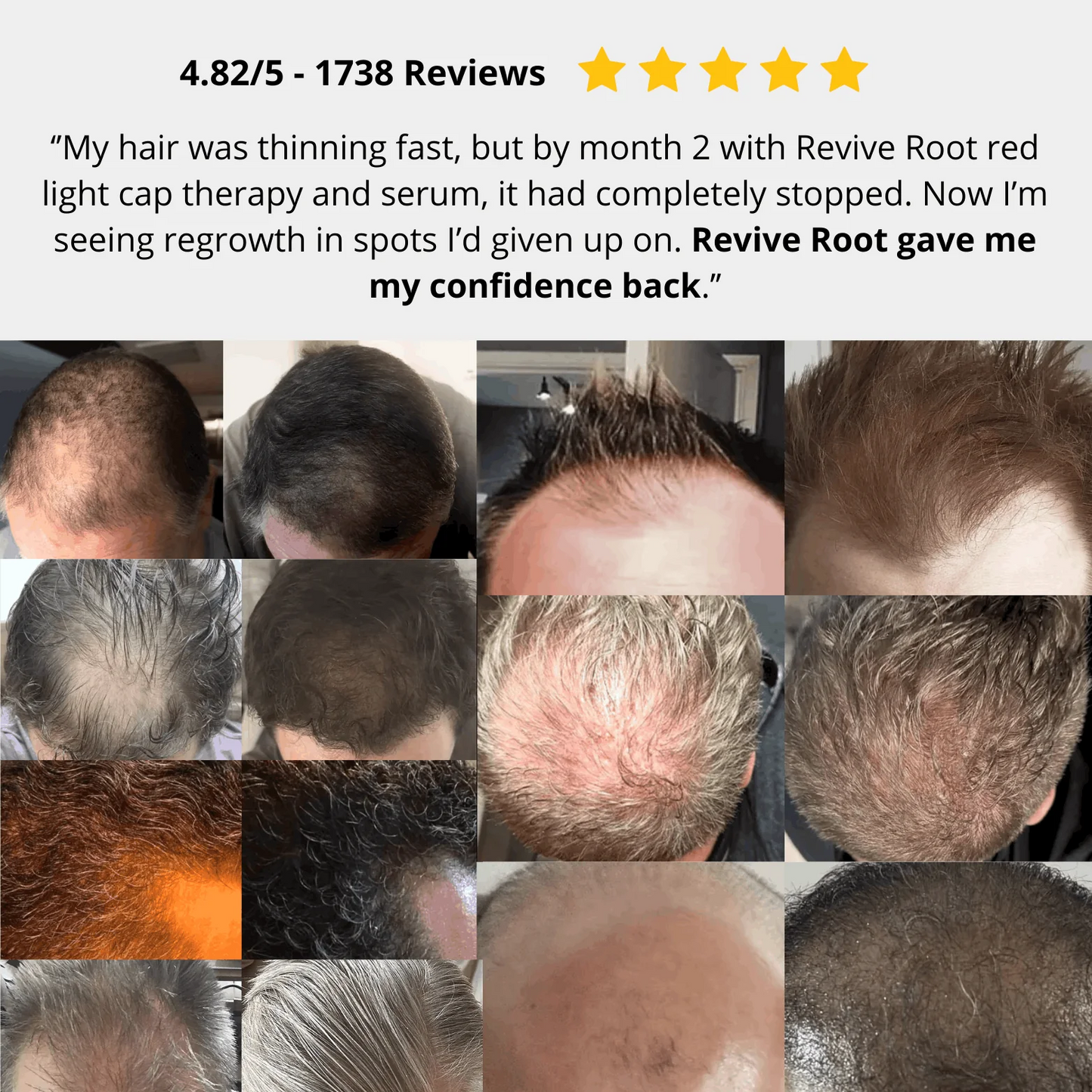 Red Light Therapy Cap for Hair Regrowth Treatments