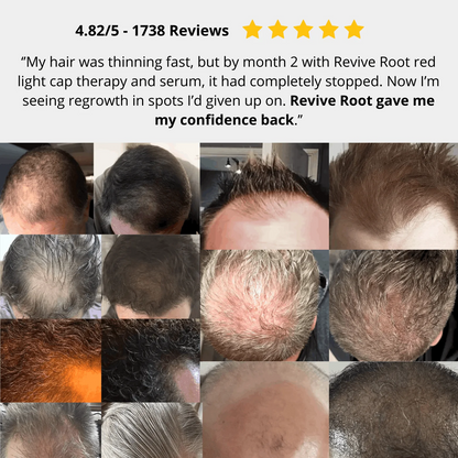 Red Light Therapy Cap for Hair Regrowth Treatments