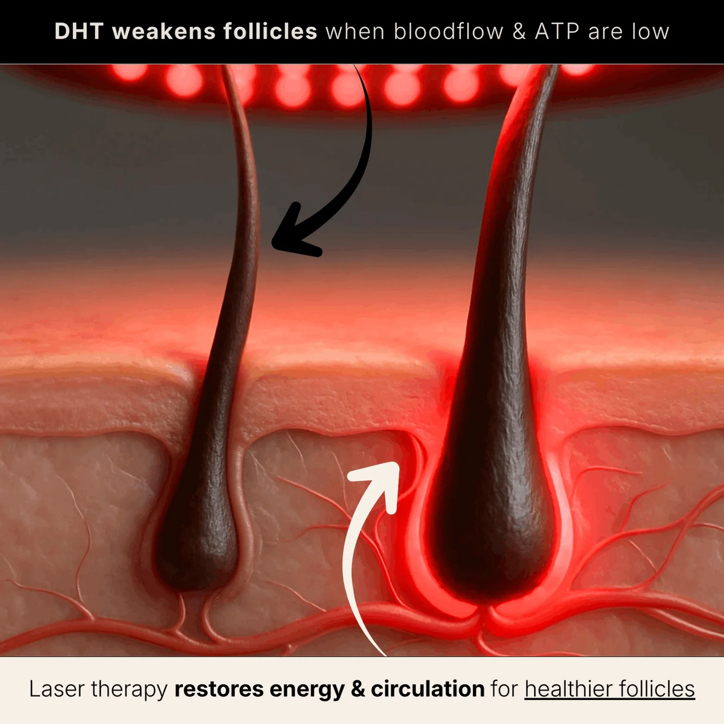 Red Light Therapy Cap for Hair Regrowth Treatments